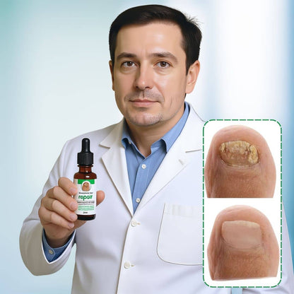 Natural Profesional Serum For Nail