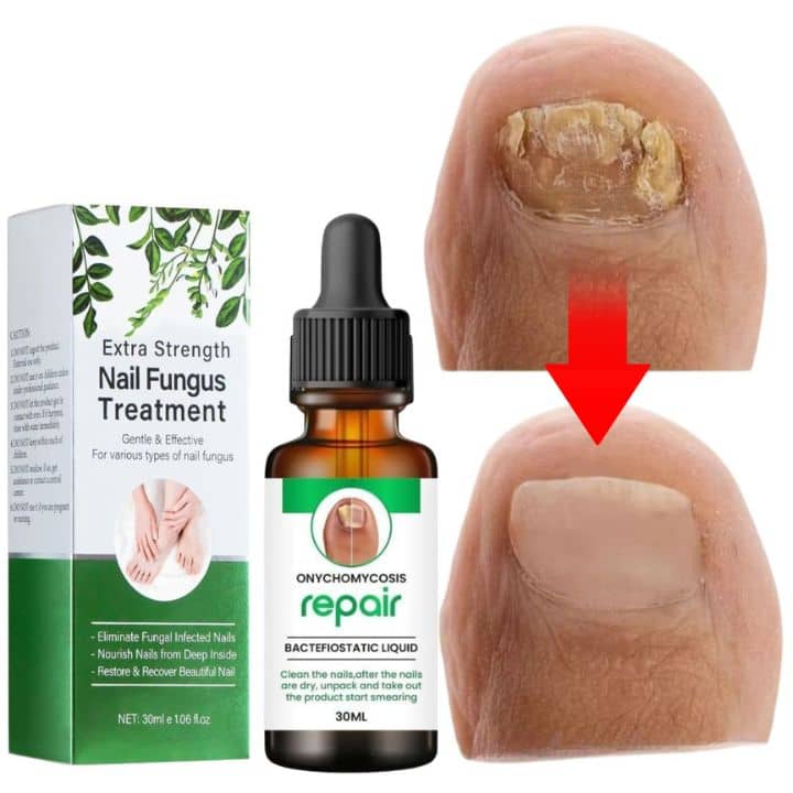 Natural Profesional Serum For Nail