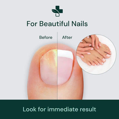 Natural Profesional Serum For Nail